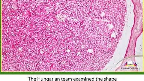 Action 11. Module 3. The Rosehip Neurone - A New Type of Brain Cell