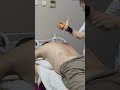 Cupping therapy of traditional Chinese medicine #cuppingtherapy #chinesetraditionalmedicine