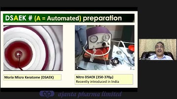 Endothelial Keratoplasty- Dr. Samar Basak