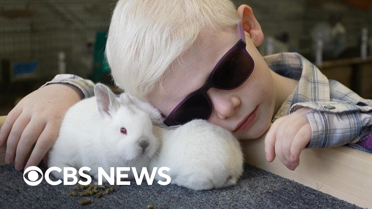 Texas boy with cancer raises award-winning rabbits