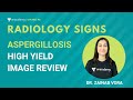 Radiology Signs | High Yield image review in radiology | Aspergillosis | Dr. Zainab Vora