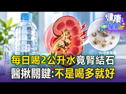 Got Kidney Stones Even After Drinking 2 Liters of Water a Day? Doctor Reveals: 4 Ways to Properly...