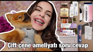 ÇİFT ÇENE AMELİYATI | SORU CEVAP (KULLANDIĞIM ÜRÜNLER)