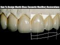 How to Design World-Class Cosmetic Maxillary Restorations