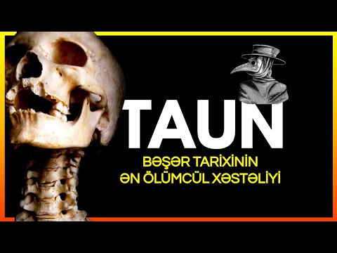 Taun: Ən Ölümcül Xəstəlik | Elm Azərbaycan