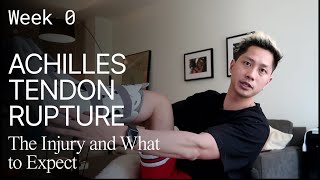 Week 0 - Achilles Tendon Rupture - Surgical Repair - The Injury and What to Expect