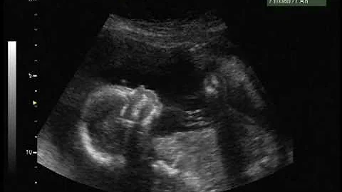 Abby Lynn Doucette