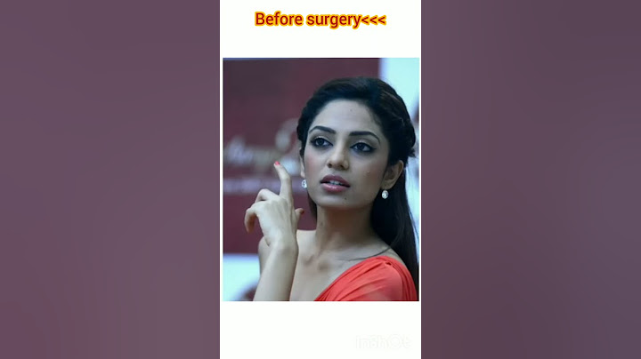 How sobhita looks Before surgery 🤗 #shortfeed #song #sobhitadhulipala #trendingshorts