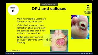 Certified Wound Specialist (CWS) Prep Course screenshot 3