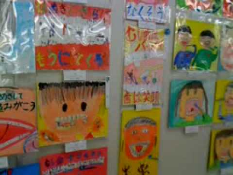 歯っぴいフェア2010　前日２