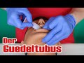 Anwendung des guedeltubus  sanitter basics