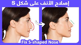 2 mins!! Fix S-shaped and crooked nose |  إصلاح الأنف المنحني: جعله أكثر استقامة، ورفعه