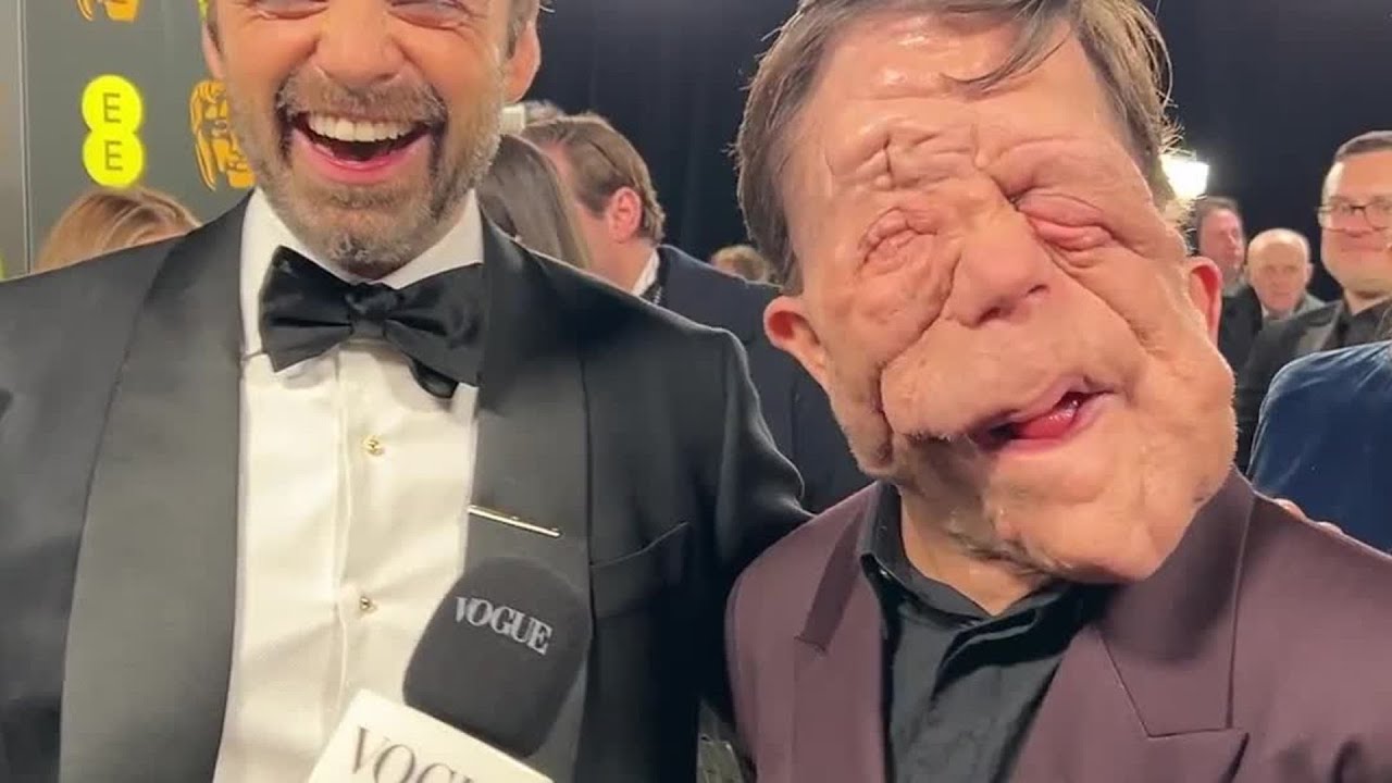 Sebastian Stan & Adam Pearson Reunite On The Red Carpet