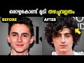 How To Grow Hair Faster | Hair Growth Tips For Men | Malayalam #HairGrowth