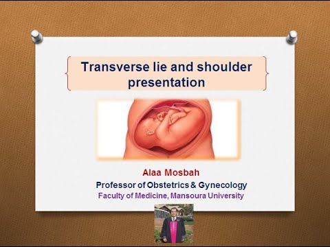 transverse lie the presentation is