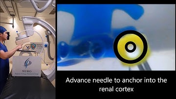 "Bullseye" PCNL demonstration- Model