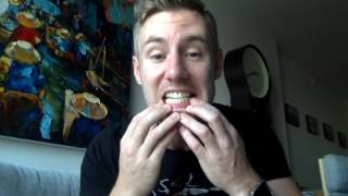 My Invisalign Journey: Fixing my teeth in Bangkok, 25% finished!