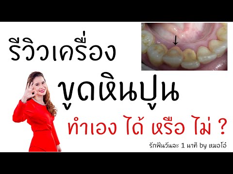 รีวิว เครื่องขูดหินปูนแบบใช้ที่บ้านทำเองได้มั๊ย/รักฟันวันละ1นาทีbyหมอโอ๋