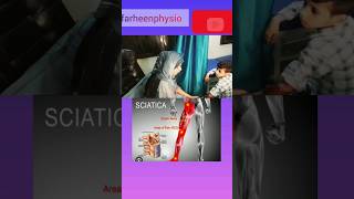 Sciatica/back pain/numbness in lower limb Dr.farheenphysiophysiotherapy viralvideo viralshorts