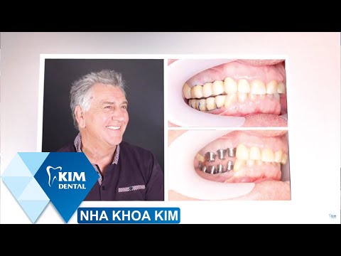 Video Hình ảnh KH Trồng Răng Implant Tại Nha Khoa KIM - youtube