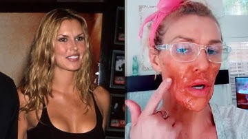 Beroemdheden die hun lichaam verwoestten voor roem