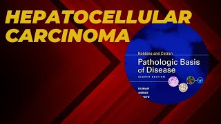 Hepatocellular carcinoma | Risk factors | Pathogenesis | Morphology | Clinical features