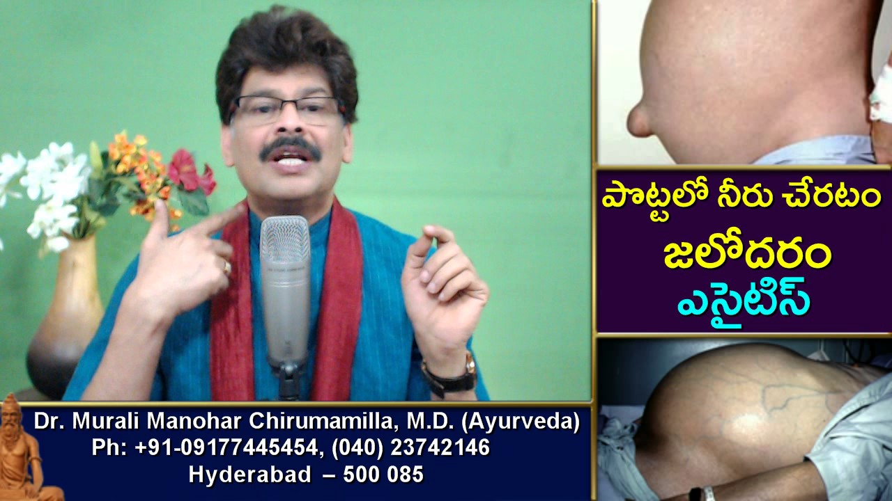 Home Remedies and Ayurvedic Treatment for Ascites (Fluid in Abdominal cavity) in Telugu by Dr. Murai