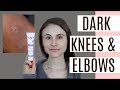 FADE DARK ELBOWS & KNEES| Q&A WITH DERMATOLOGIST DR DRAY
