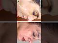 Skincare#youtubeshorts #ytshorts #yt#shorts#viral#skincare#selfcare#womeniaatf