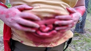 ЧТО БУДЕТ ЕСЛИ ПРОГЛОТИТЬ ИГОЛКУ?!! ЧТО БУДЕТ ЕСЛИ ПРОГЛОТИТЬ ИГОЛКУ?!!
