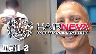 Meine Haartransplantation in der Türkei, komplett dokumentiert!