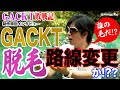 【GACKT敗戦記制作特別インタビュー】GACKTが脱毛！？路線変更か？GACKTが絶望した衝撃の病状とは！？【死を覚悟した病】