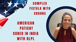 US Atlantica Crohn’s disease cured with Laser DLPL operation for Anal Fistula in Vagina.Failed Seton
