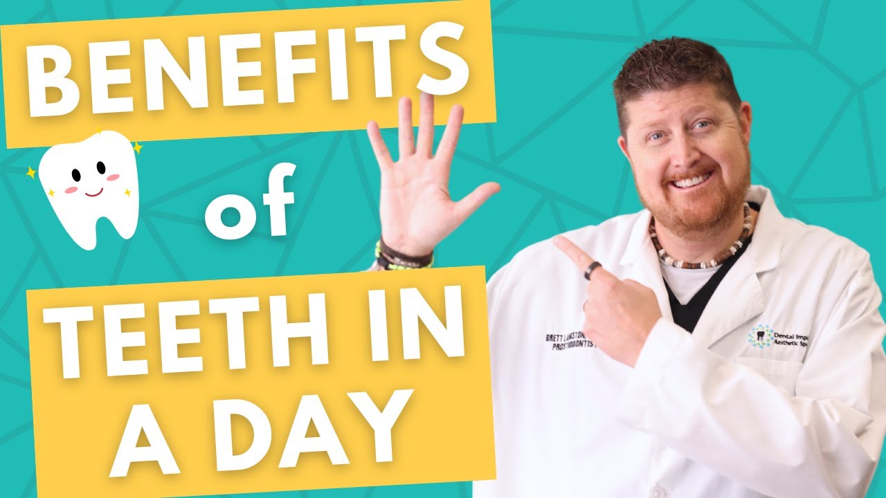 The 5 BIGGEST Benefits of Teeth in a Day Dental Implants YouTube