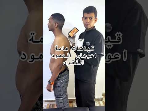 قياسات هامة اعوجاج العمود الفقرى دكتور محمد علاء