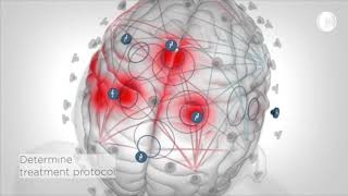 Read and Re-write Pain in the Brain: Elminda and Soterix Medical at Israel Brain Tech 2013