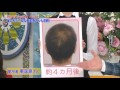 イチオシ！ショッピング／ビタブリッドCヘアートニックセット