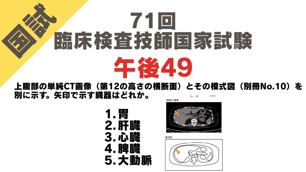 第71回臨床検査技師国家試験【午後】 解説・裏回答・周辺知識まとめ