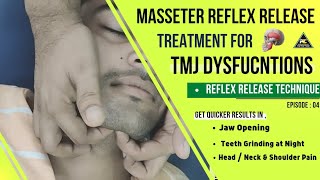 TMJ DISORDER TREATMENT BY REFLEX RELEASE TECHNIQUE :HELPFUL IN MOUTH OPENING/ BRUXISM HEAD/NECK PAIN