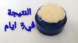 سواد 20سنه سيذهب في3ايام  ضعيها 3 ايام متتالية تبيض الوجه والجسم كله  سيتفاجئ الناس من بياضك