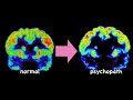 Psychopath Brain Subliminal Become A High Functioning Psychopath Psychopath Brain Subliminal Become A High Functioning Psychopath