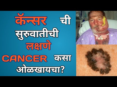 Cancer symptoms in marathi । कॅन्सर ची सुरुवातीची लक्षणे ।