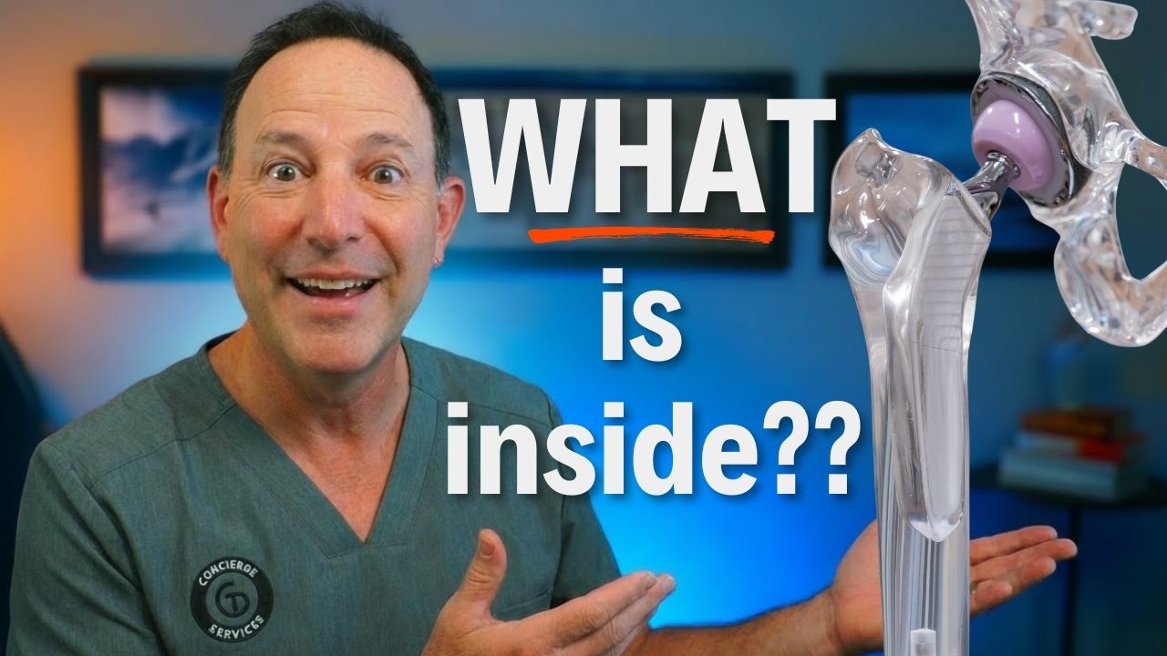 Your Hip Replacement Material Determines Everything. Here's Why