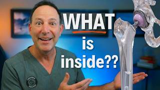 Your Hip Replacement Material Determines Everything. Here's Why