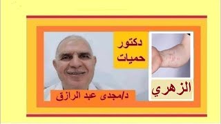 مرض الزهري وطرق انتقاله