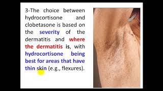 Eczema/dermatitis, Sun exposure and melanoma risk. By Dr. Dheyaa Jabbar