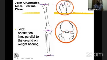 Principles of Coronal plane deformity correction