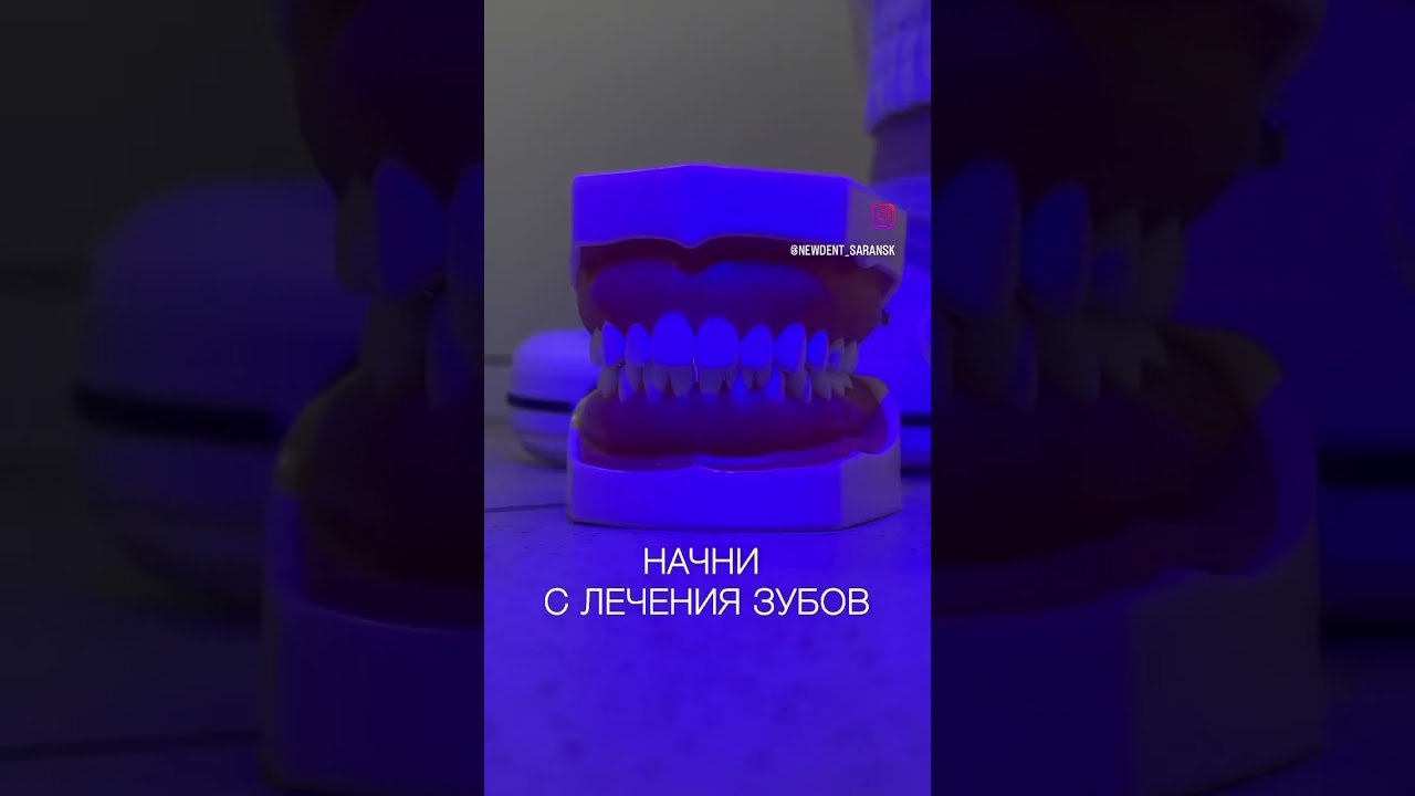 New Dent Saransk 🦷 📲300-699  