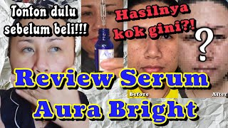 Honest Review of Aura Bright Serum || Serum to Remove Acne Scars