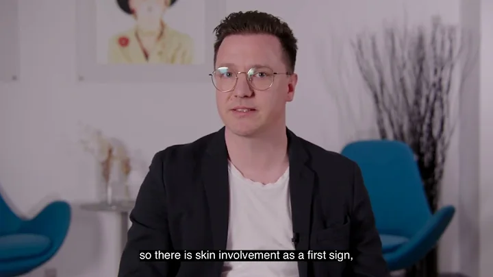 How is Psoriatic Arthritis diagnosed?